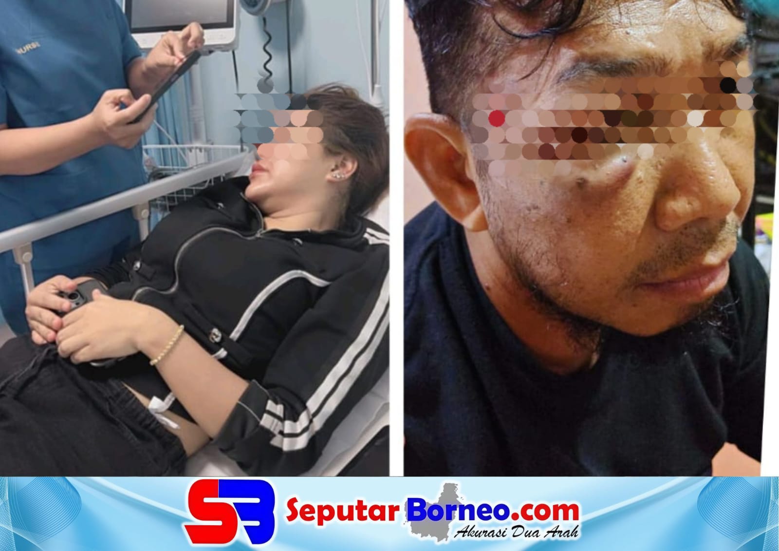 Sudah Lapor Sejak April, Terduga Pelaku KDRT dan Penganiayaan Belum Diamankan Polda Kalteng