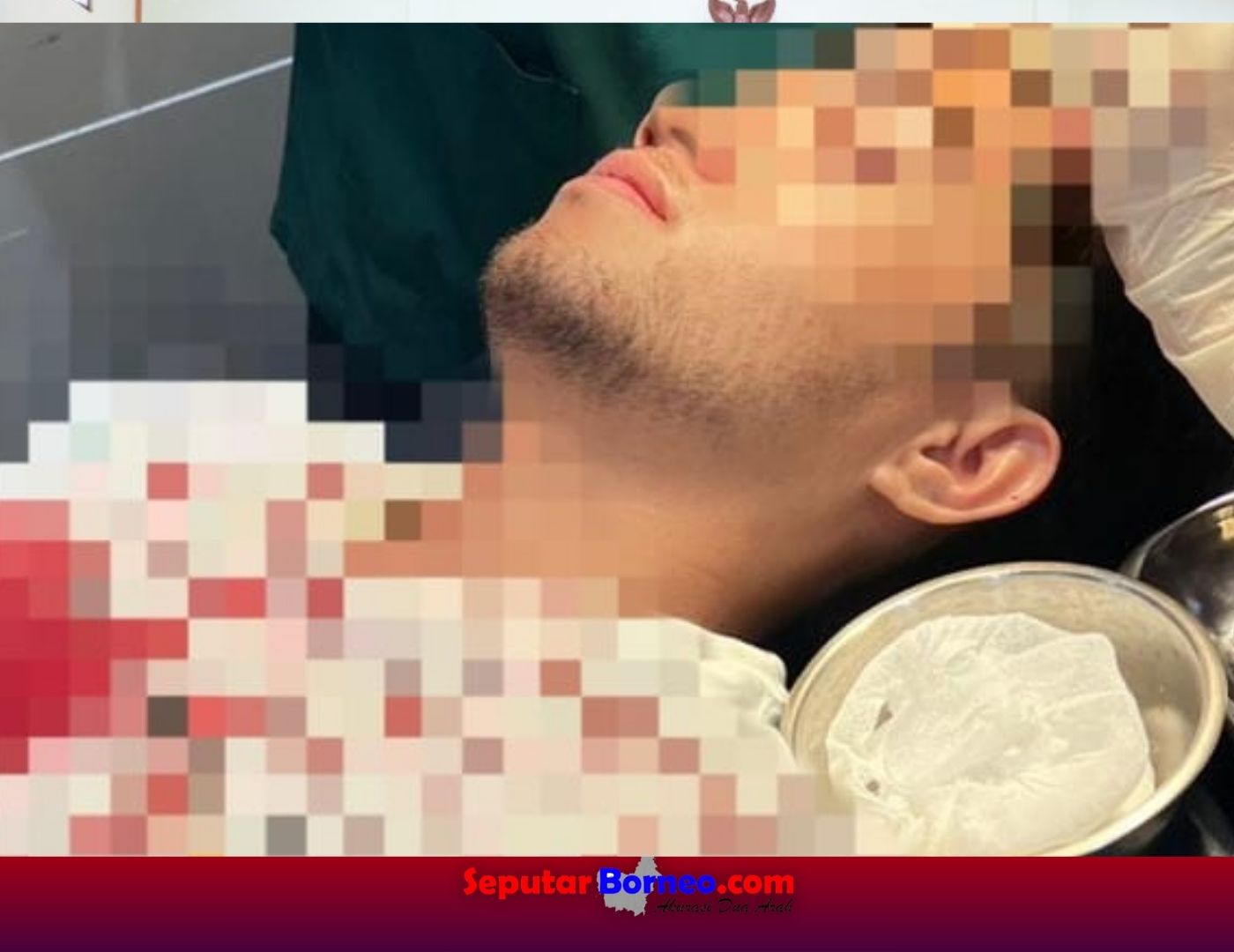 Dikeroyok Dua Pengendara Tak Dikenal, Driver Ojol di Palangka Raya Berlumuran Darah